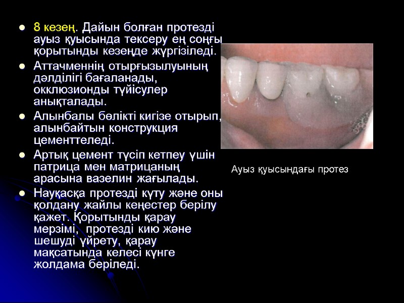 8 кезең. Дайын болған протезді ауыз қуысында тексеру ең соңғы қорытынды кезеңде жүргізіледі. 